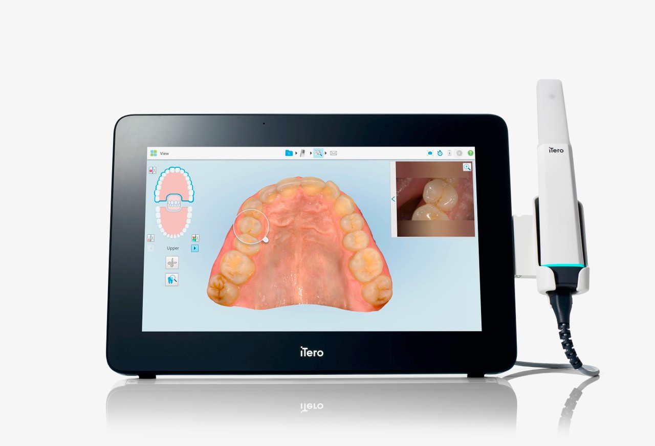 iTero monitor with attached wand