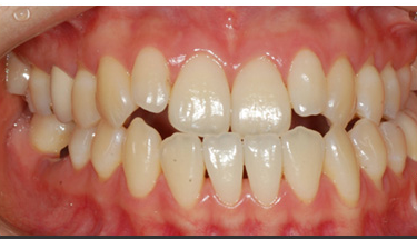 Before treatment