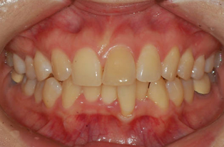 Before — Frontal View