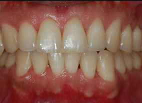 After — Frontal View